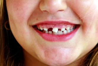 Who Won the Longest Hair Contest it Wasn't the Only Surprise