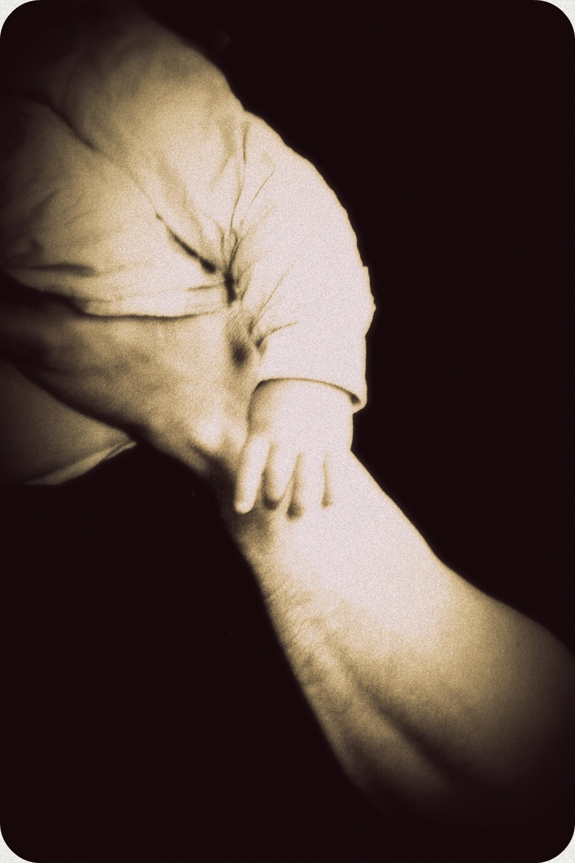 Arm and hand Arm and hand