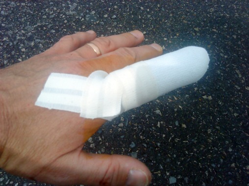 Yann's finger Yann's finger